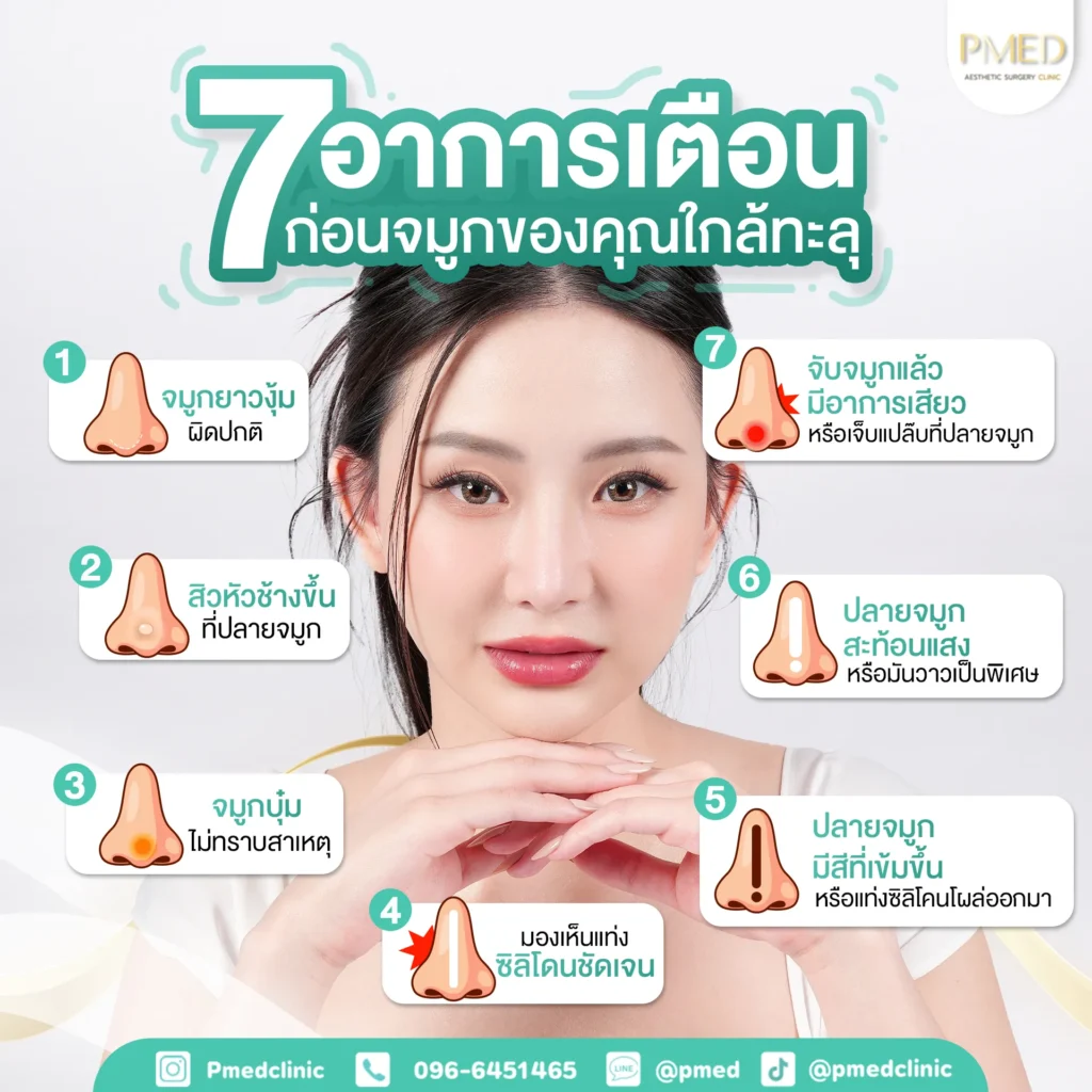 เสริมจมูกคืออะไร? รู้ครบทุกเรื่องก่อนตัดสินใจเสริมจมูกครั้งแรก 3 เสริมจมูกคืออะไร? รู้ครบทุกเรื่องก่อนตัดสินใจเสริมจมูกครั้งแรก