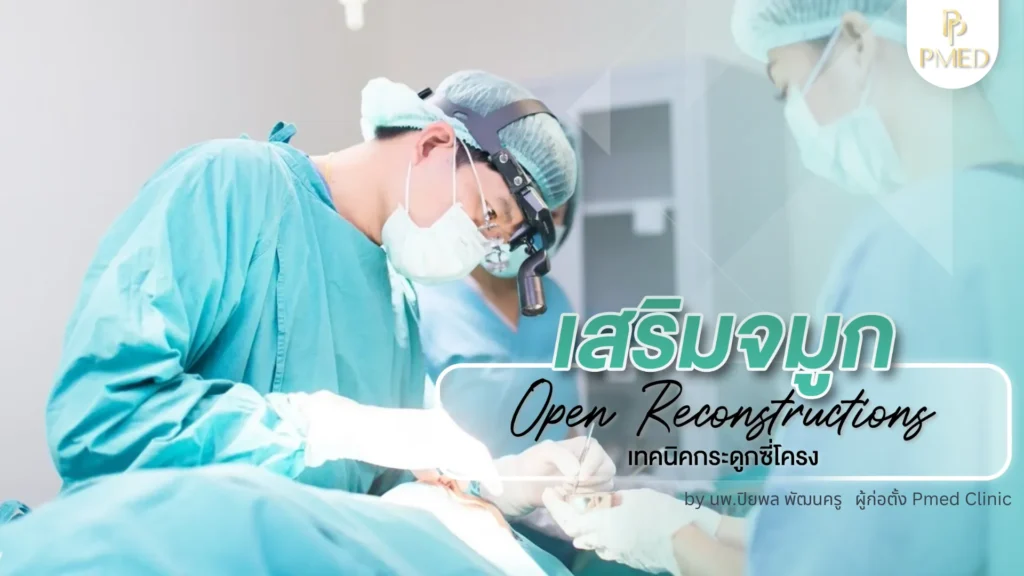 การเสริมจมูกด้วยกระดูกอ่อนซี่โครงคืออะไร? ทางเลือกที่ปลอดภัย สวยเป็นธรรมชาติ และอยู่ได้นาน 3 Vision Board. 11zon