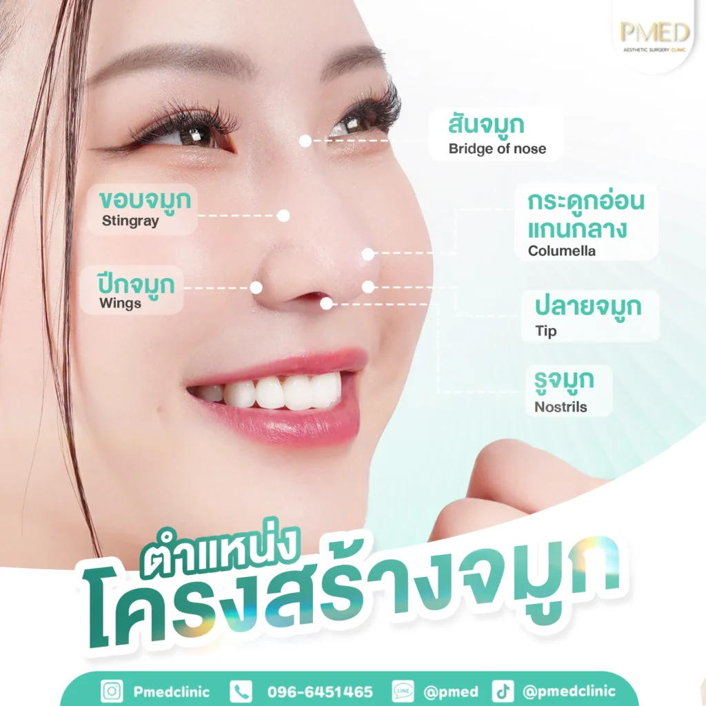 การแก้จมูกแบบโอเพ่นคืออะไร? ทางเลือกสำหรับคนที่อยากแก้จมูกอย่างเห็นผล 3 การแก้จมูกแบบโอเพ่นคืออะไร? ทางเลือกสำหรับคนที่อยากแก้จมูกอย่างเห็นผล