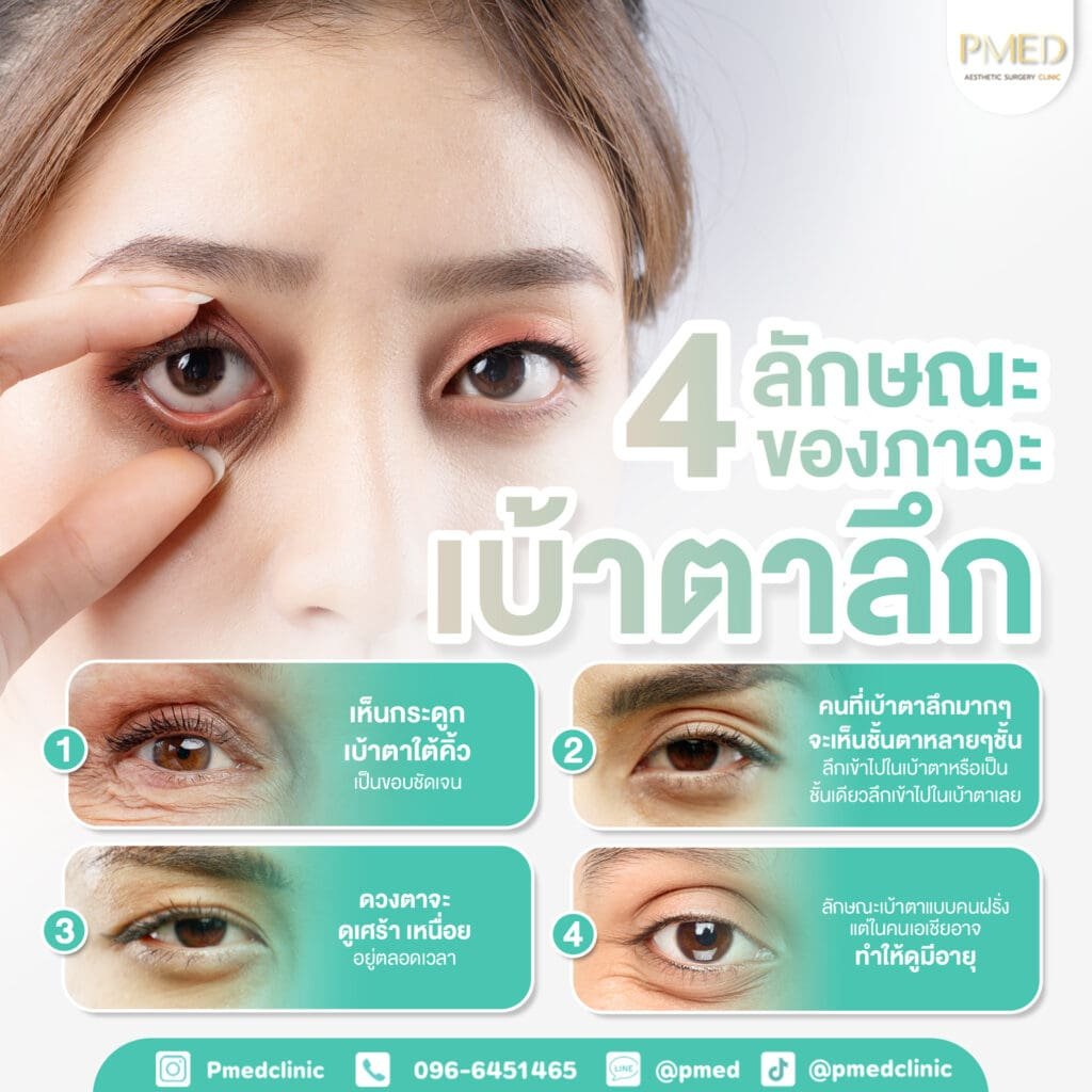 จัดเรียงและเติมไขมัน 9 4ลักษณะเบ้าตา TH PMED