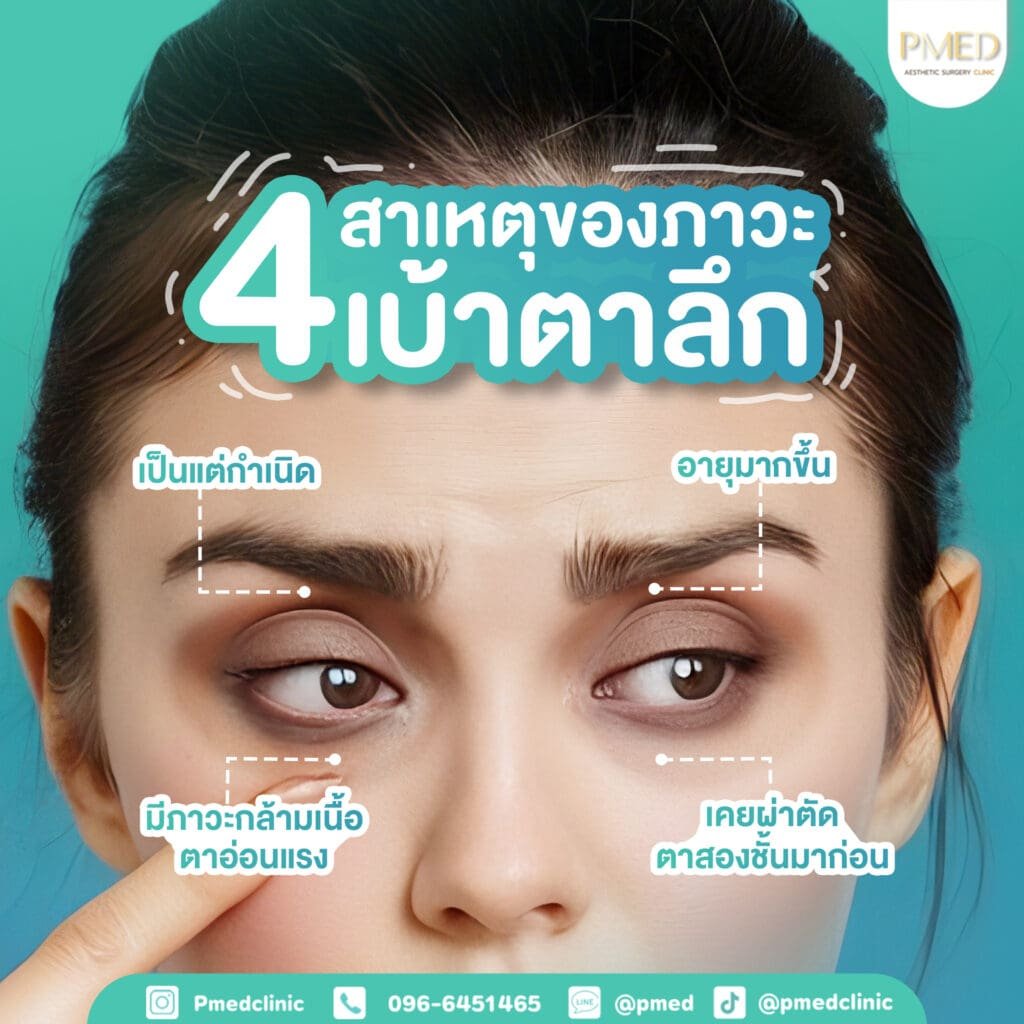 จัดเรียงและเติมไขมัน 11 4เบ้าตาลึก TH PMED