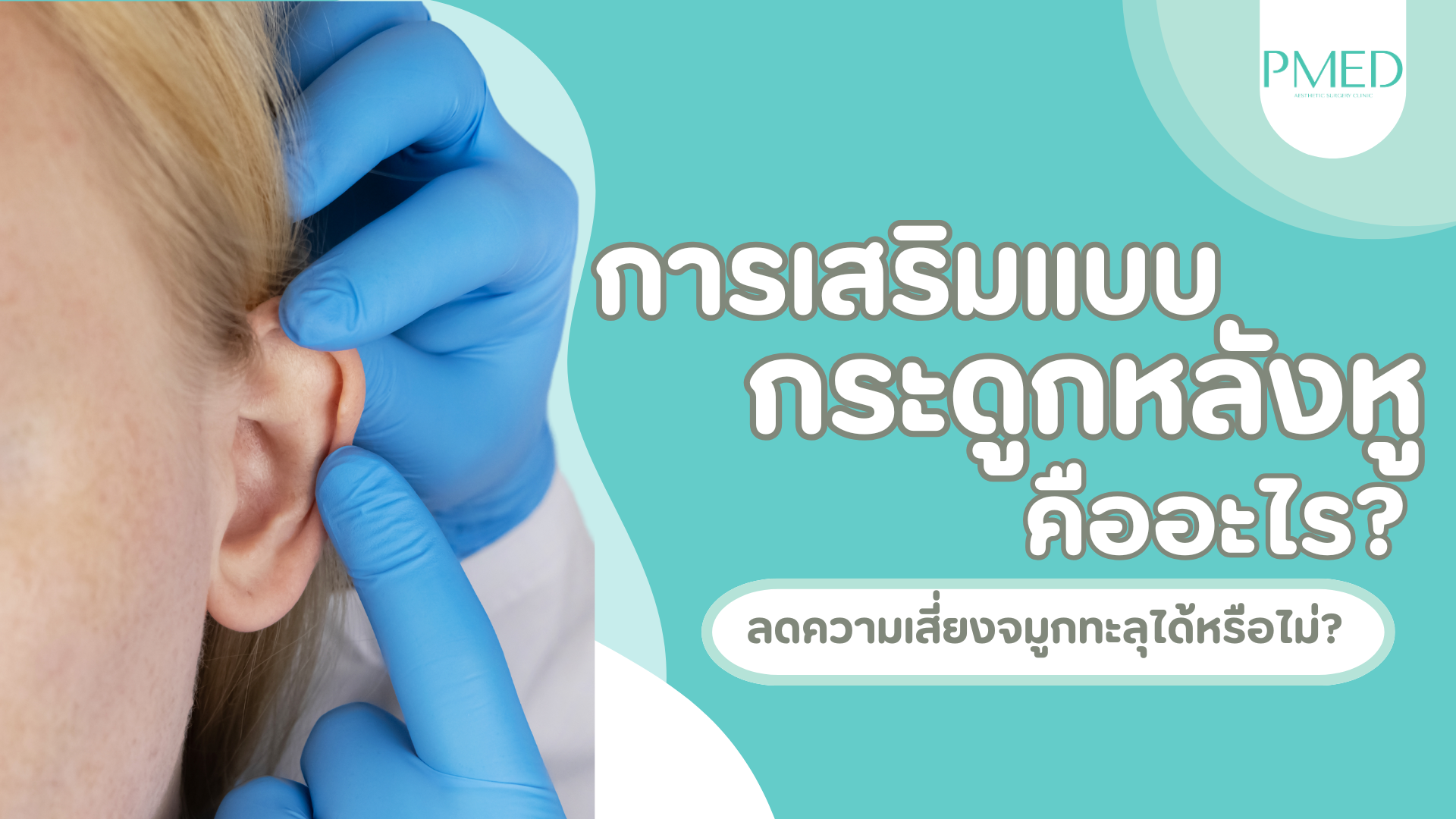 การเสริมจมูกด้วยกระดูกอ่อนหลังหูคืออะไร? ลดความเสี่ยงจมูกทะลุได้หรือไม่? 1 เสริมจมูกกระดูกอ่อนหลังหู