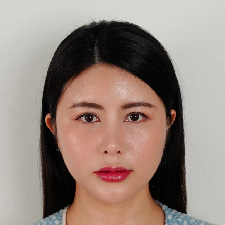 รีวิวเติมไขมัน10.1