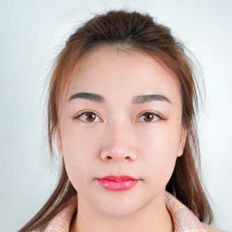 รีวิวเติมไขมัน20.1