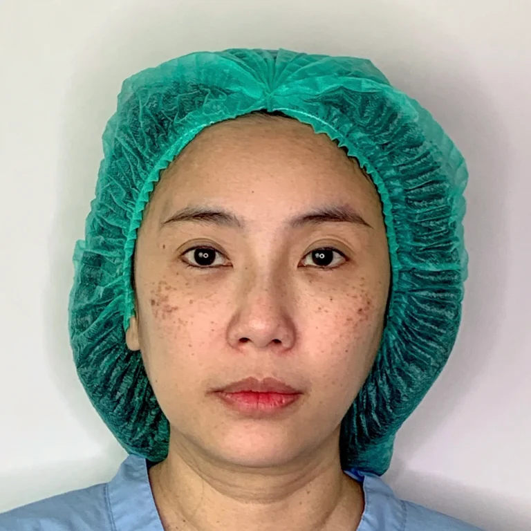 รีวิวเติมไขมัน27.1