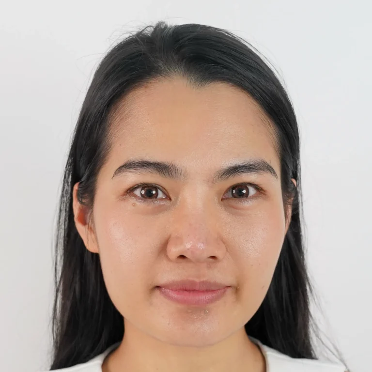 รีวิวเติมไขมัน29.1