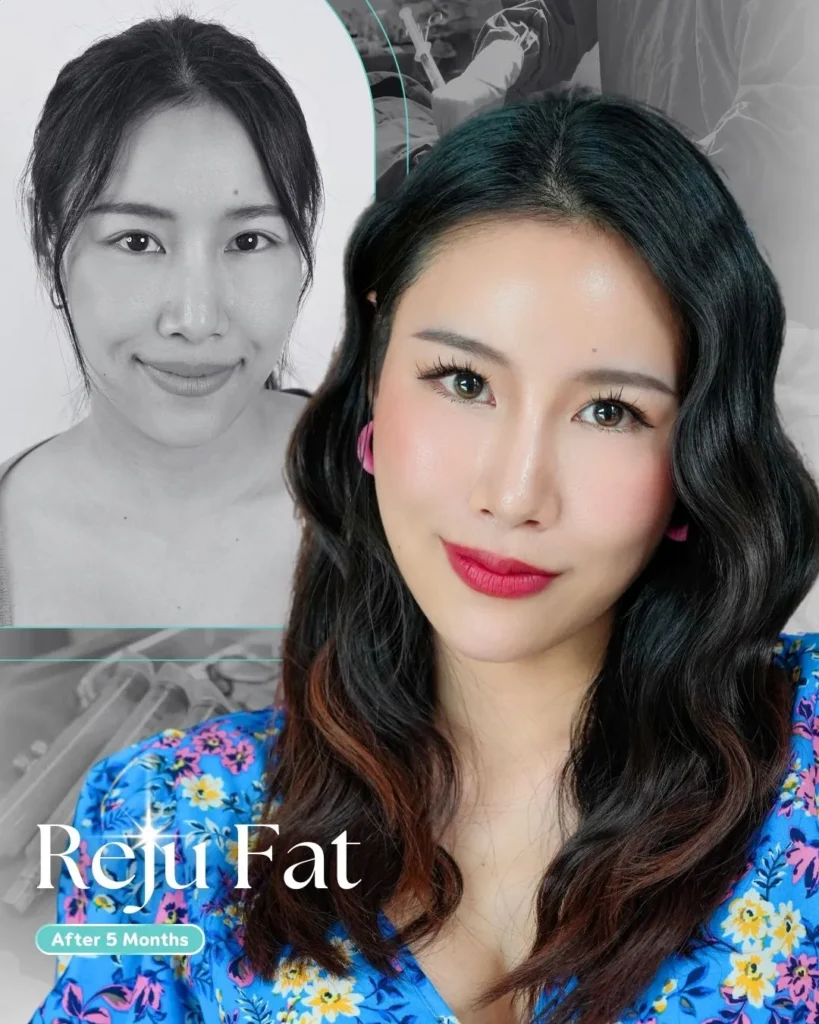 แหล่งที่มาของ Growth Factor เข้าใจให้ลึกก่อนเลือกใช้เพื่อการฟื้นฟูผิวอย่างปลอดภัย