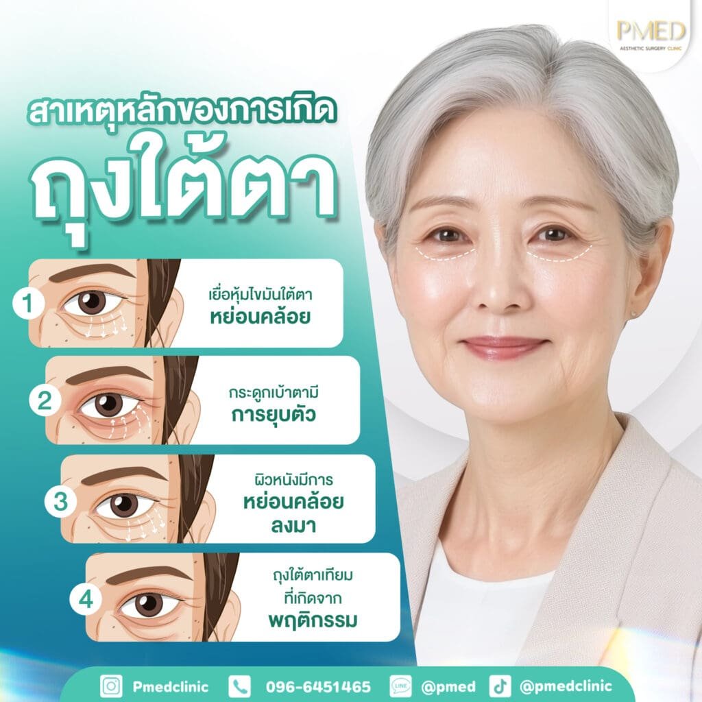 สาเหตุหลัก TH PMED