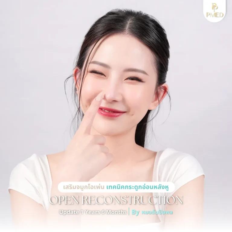 ใครเหมาะกับเสริมจมูก