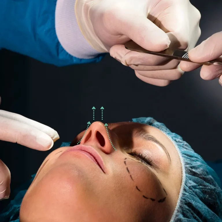 ยืดผนังกั้น