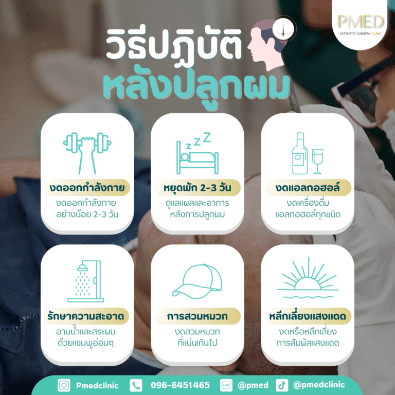 หลังปลูกผม