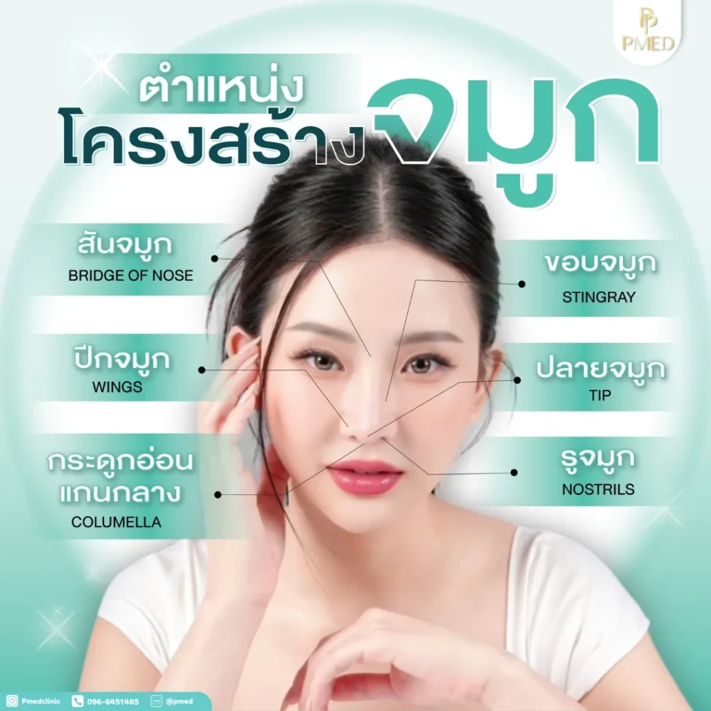 4 เทคนิคหลักที่ใช้ในการแก้จมูกแบบโอเพ่น (Open Revision Rhinoplasty) 2 เทคนิคหลักที่ใช้ในการแก้จมูกแบบโอเพ่น (Open Revision Rhinoplasty)