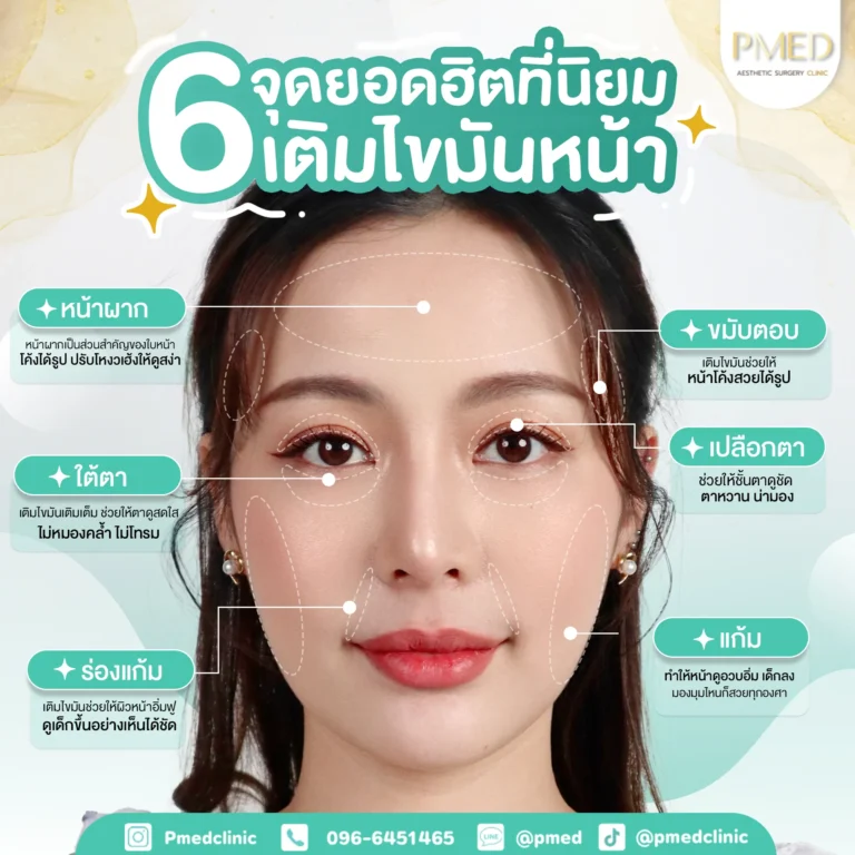 ฉีดไขมันหน้าฉีดตรงไหนได้บ้าง และแต่ละจุดให้ผลยังไง