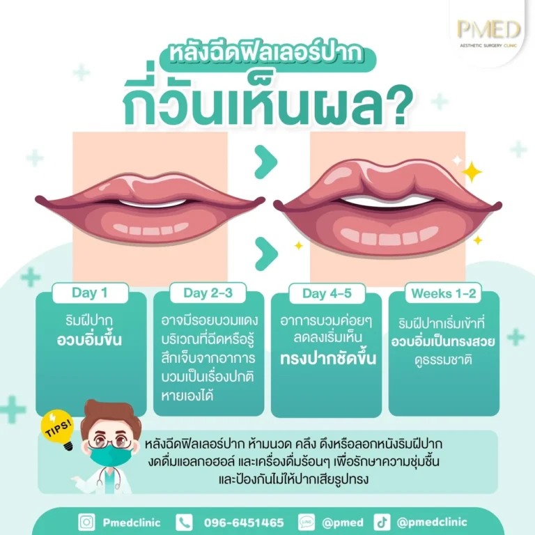 ฉีดฟิลเลอร์กี่วันเห็นผลลัพธ์