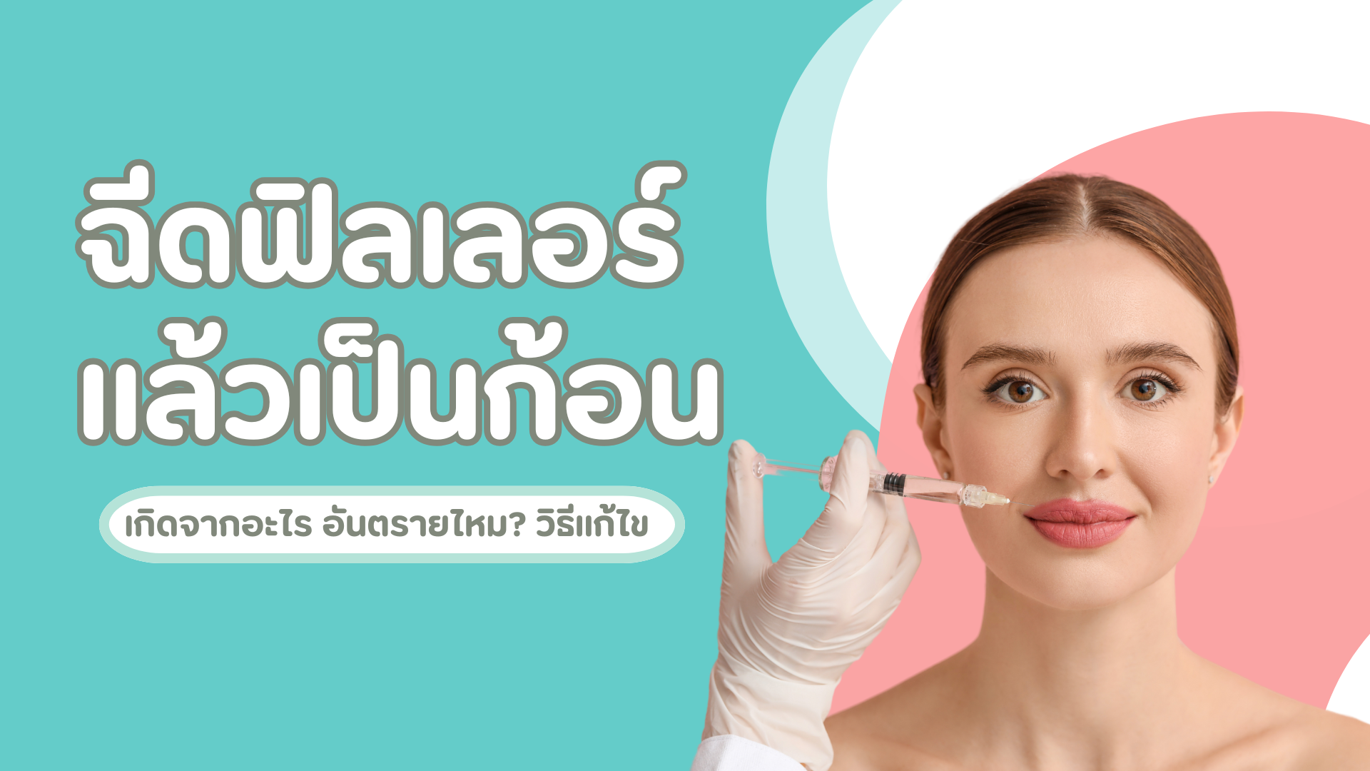 ฉีดฟิลเลอร์แล้วเป็นก้อนเกิดจากอะไร? อันตรายไหม? พร้อมวิธีแก้ไข 1 ฉีดฟิลเลอร์แล้วเป็นก้อน