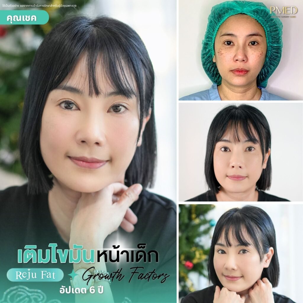 กรอบ 4 ช่องอัพเดท.zip 3