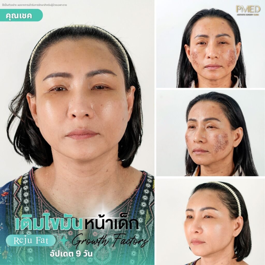 กรอบ 4 ช่องอัพเดท.zip 4