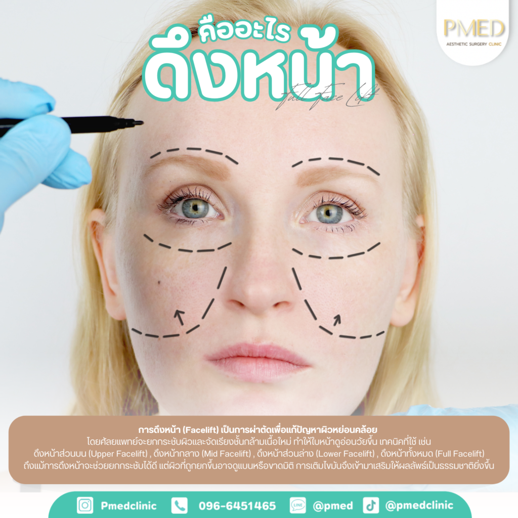 ดึงหน้าคืออะไร