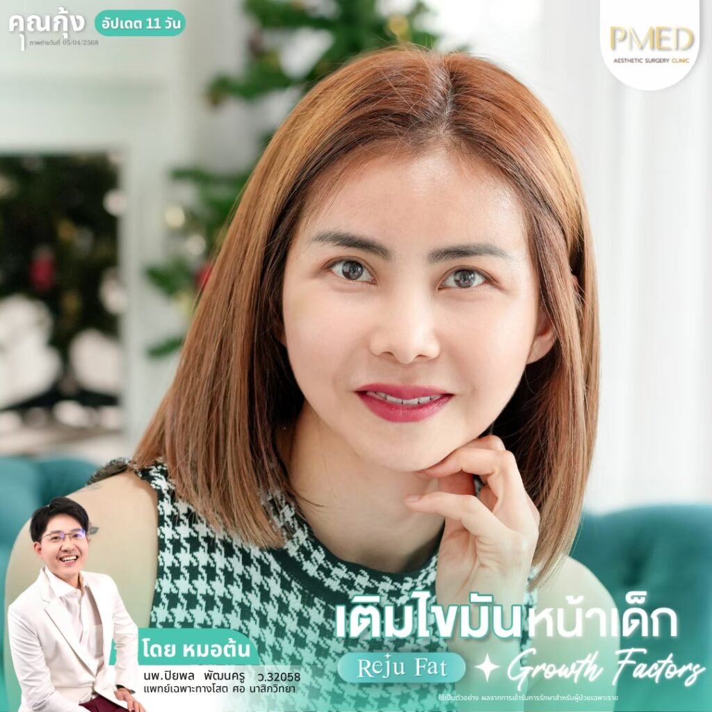 เติมไขมัน Reju Fat ✨ 260314 9