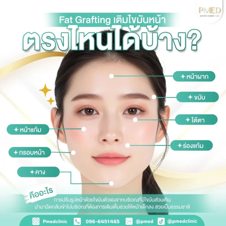 เติมไขมันหน้า เติมตรงไหนได้บ้าง