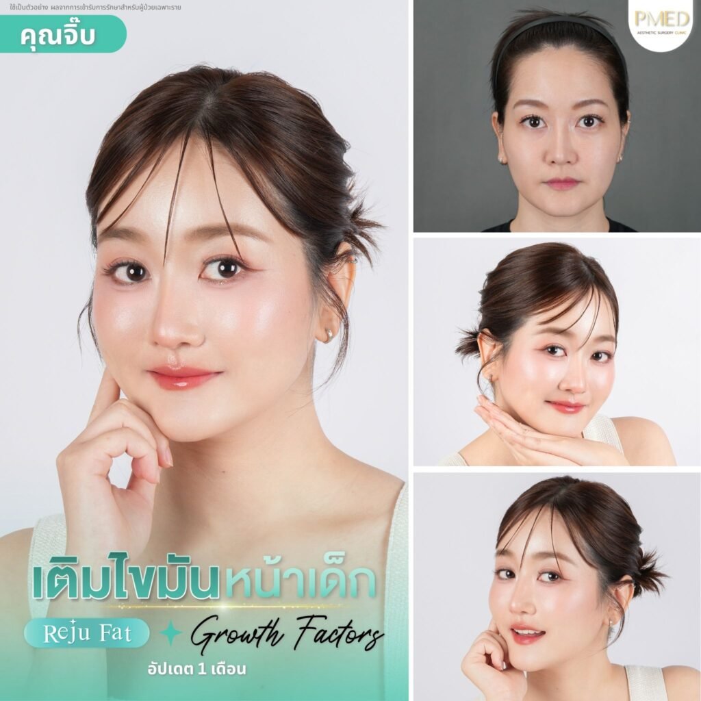 เทมเพลตจมูก 5