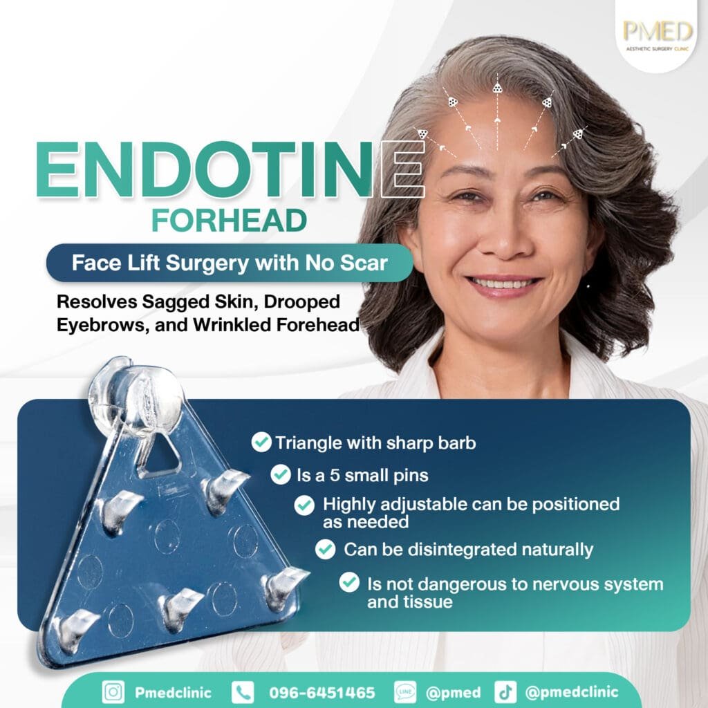 Endotine ENG PMED