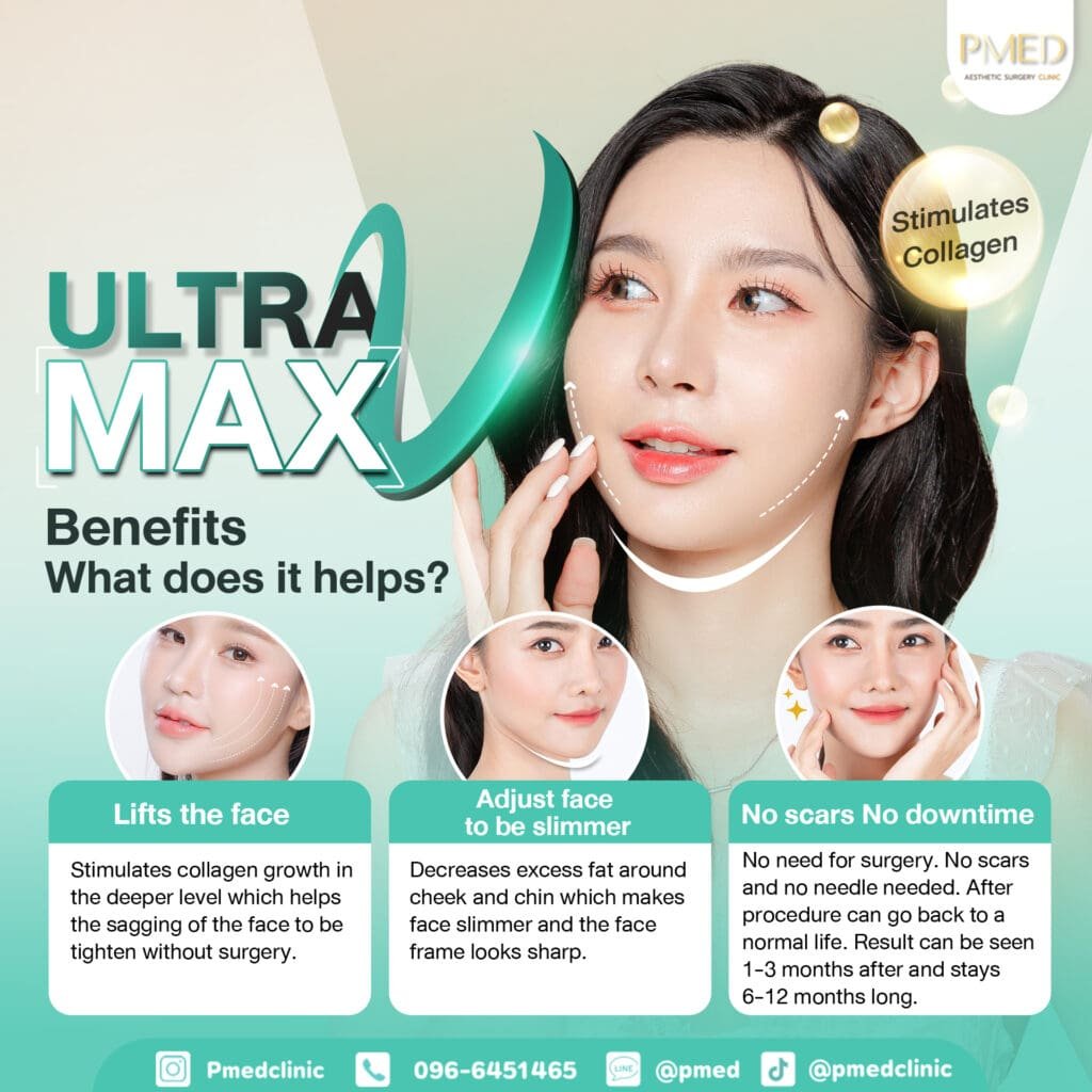 ULTRA V MAX ENG PMED
