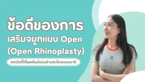ข้อดีของopen