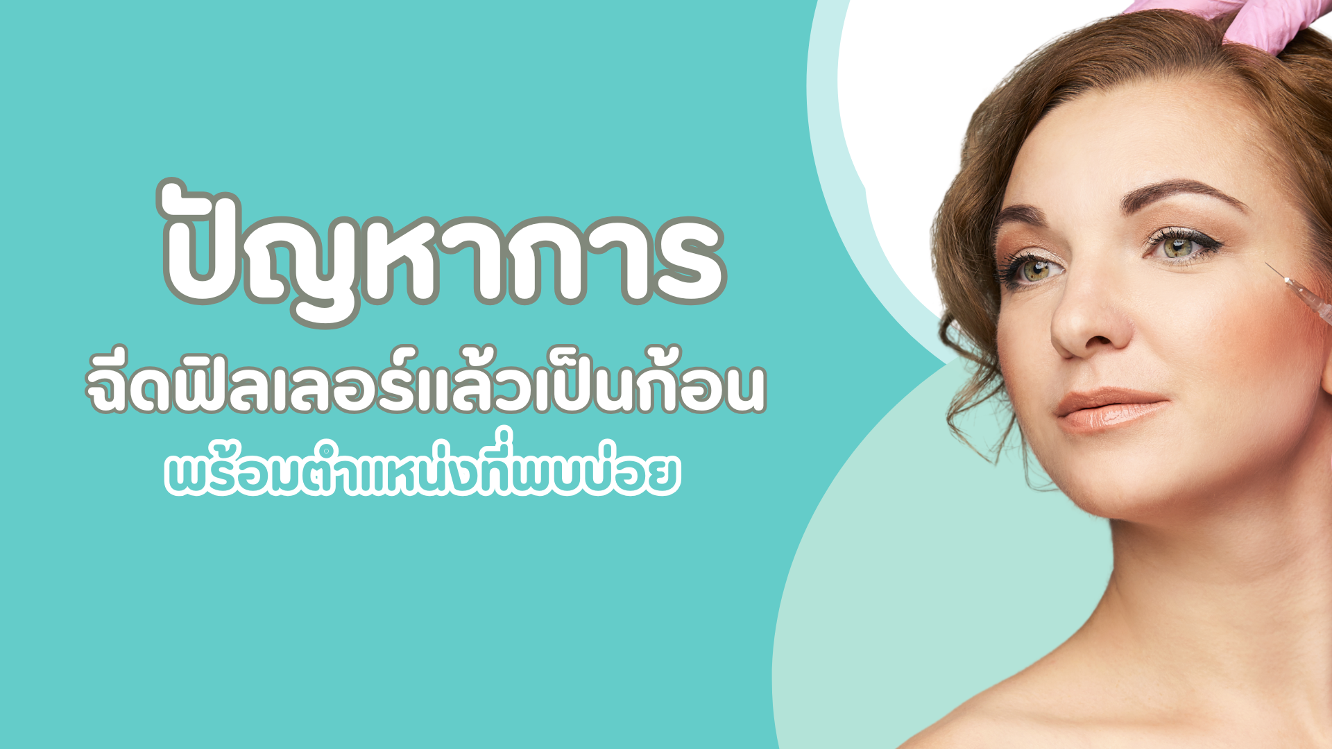 ปัญหาการฉีดฟิลเลอร์แล้วเป็นก้อน พร้อมตำแหน่งที่พบบ่อย 1 pmed-article-_48_