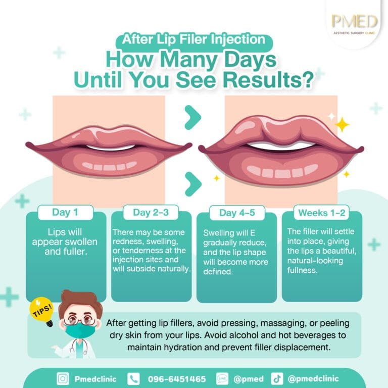 ฟิลเลอร์ปาก เห็นผล ENG PMED
