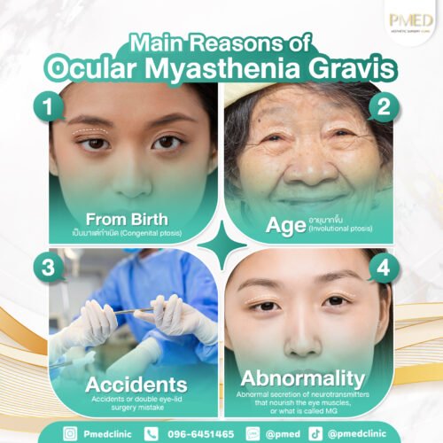 สาเหตุ ENG PMED e1747911522359