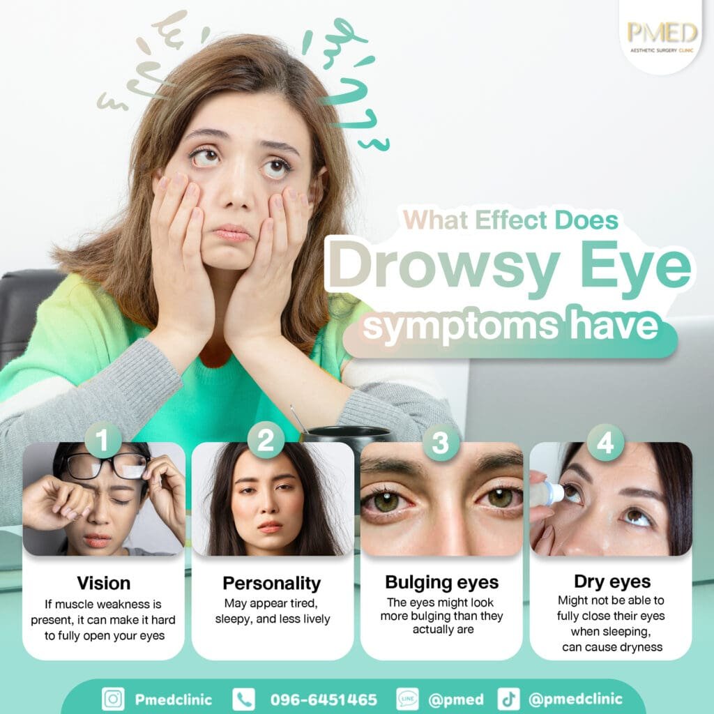 อาการตาลอย ENG PMED