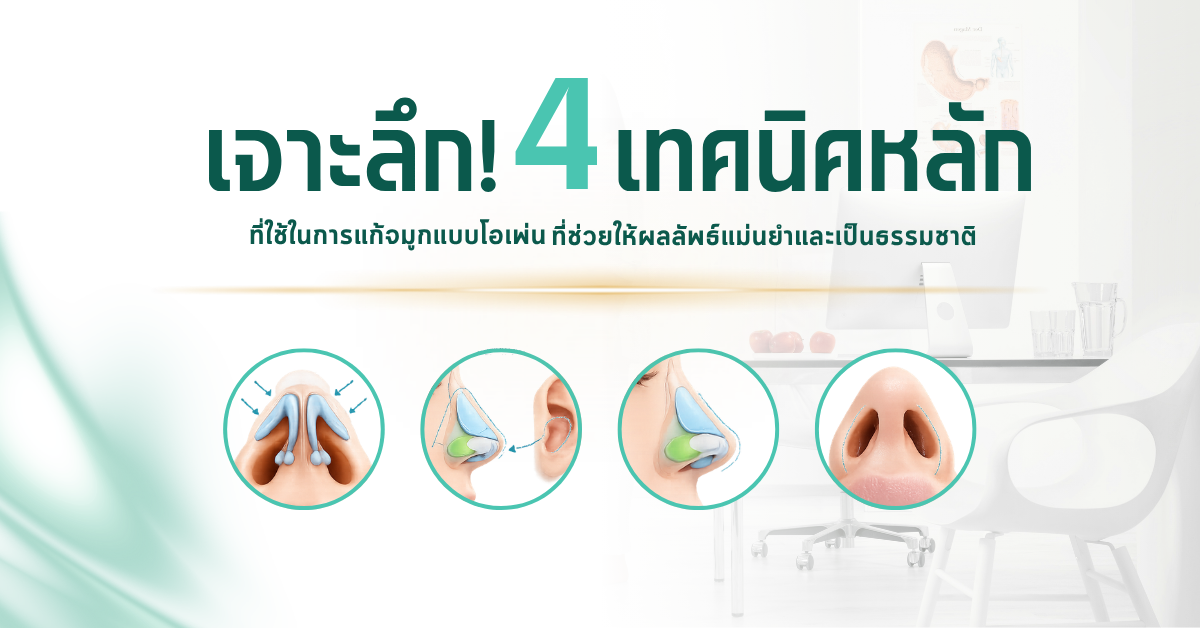 เจาะลึก! 4 เทคนิคหลักที่ใช้ในการแก้จมูกแบบโอเพ่น ที่ช่วยให้ผลลัพธ์แม่นยำและเป็นธรรมชาติ 1 10
