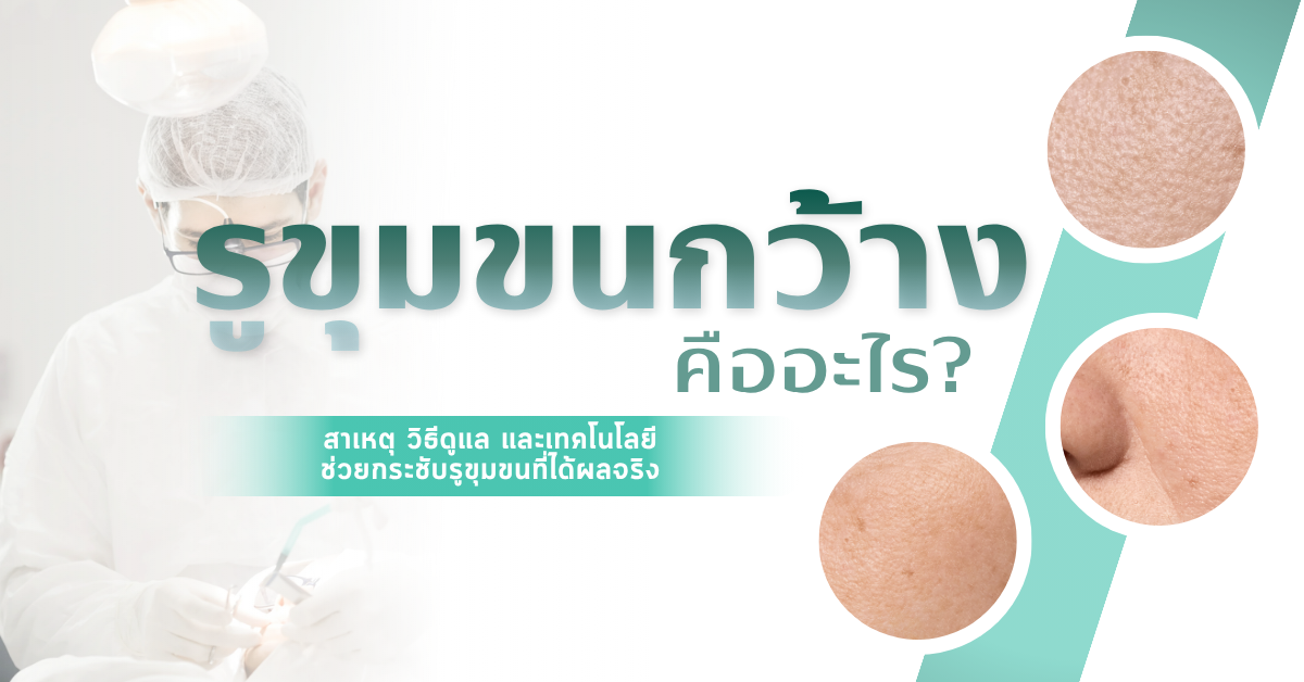 รูขุมขนกว้างคืออะไร? สาเหตุ วิธีดูแล และเทคโนโลยีช่วยกระชับรูขุมขนที่ได้ผลจริง 1 3