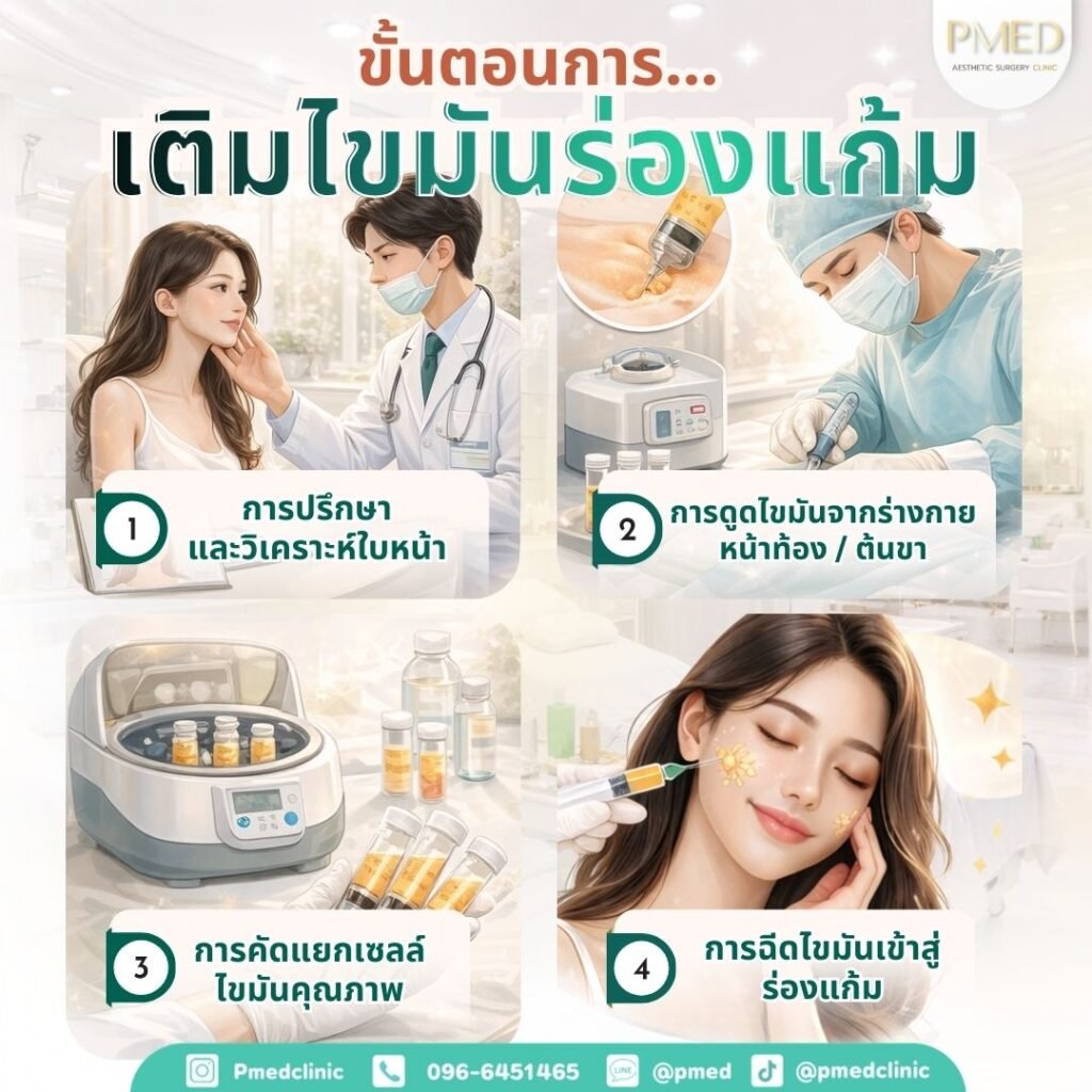 ขั้นตอนการเติมไขมันร่องแก้ม