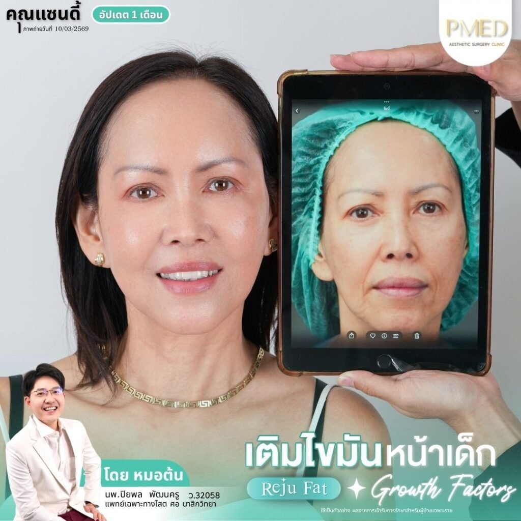 LINE ALBUM เติมไขมัน Reju Fat ✨ 260326 1