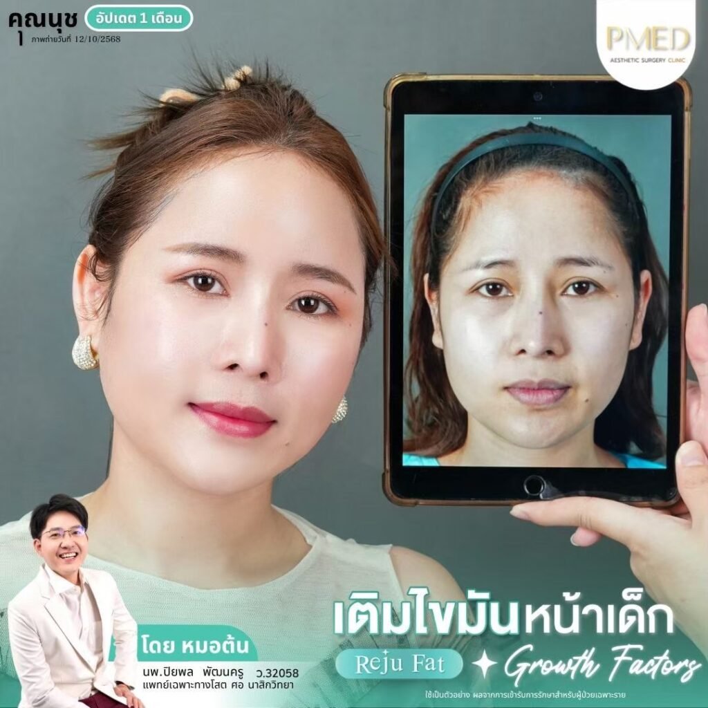 LINE ALBUM เติมไขมัน Reju Fat ✨ 260326 9