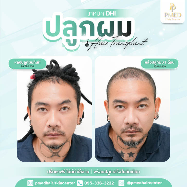 เทคนิค DHI (14)