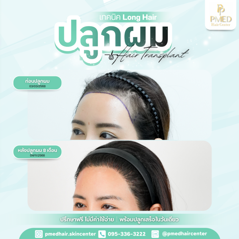 เทคนิค Long Hair (1)