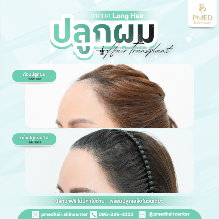 เทคนิค Long Hair (2)