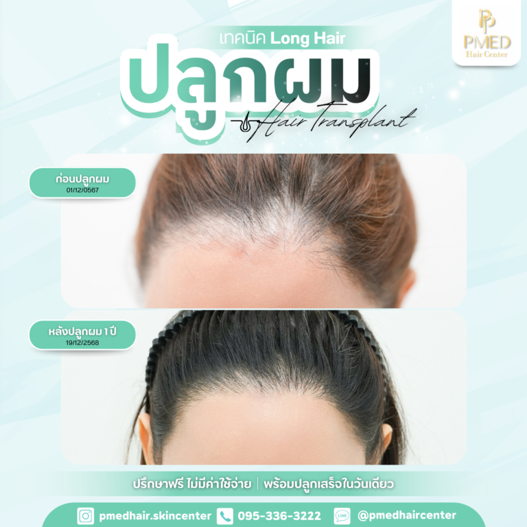 เทคนิค Long Hair (3)