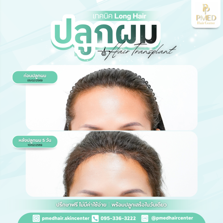 เทคนิค Long Hair (4)