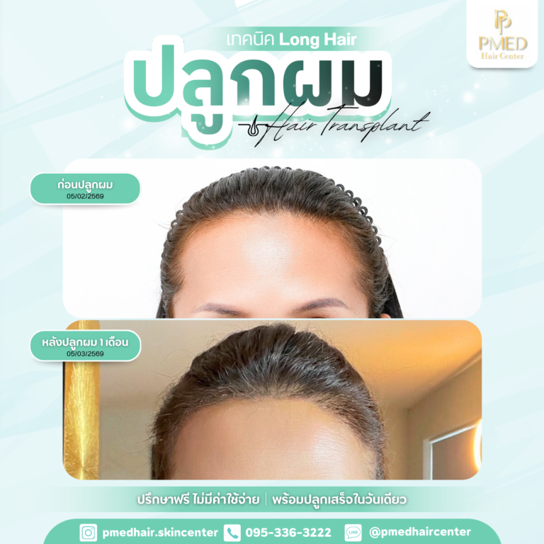 เทคนิค Long Hair (5)