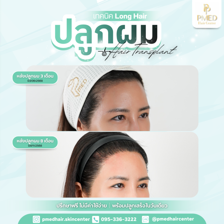 เทคนิค Long Hair