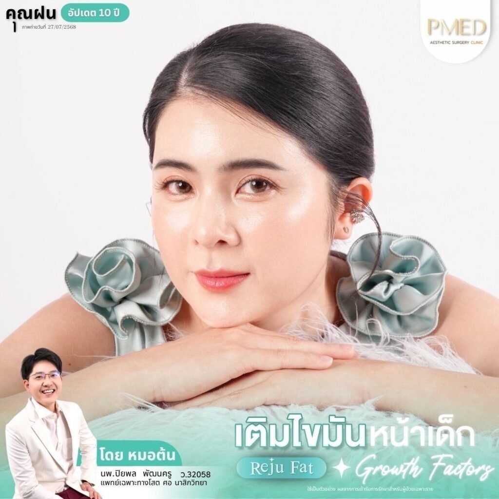 เติมไขมันหลังดึงหน้าแก้ปัญหาผิวหย่อนคล้อยในวัย 50 ปีขึ้นไป คืนความอ่อนเยาว์อย่างเป็นธรรมชาติ