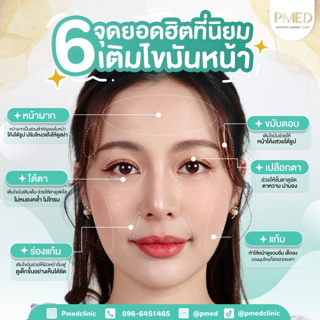 ฉีดไขมันหน้าให้ดูอ่อนเยาว์ เทคนิคคืนความสดใสอย่างเป็นธรรมชาติ