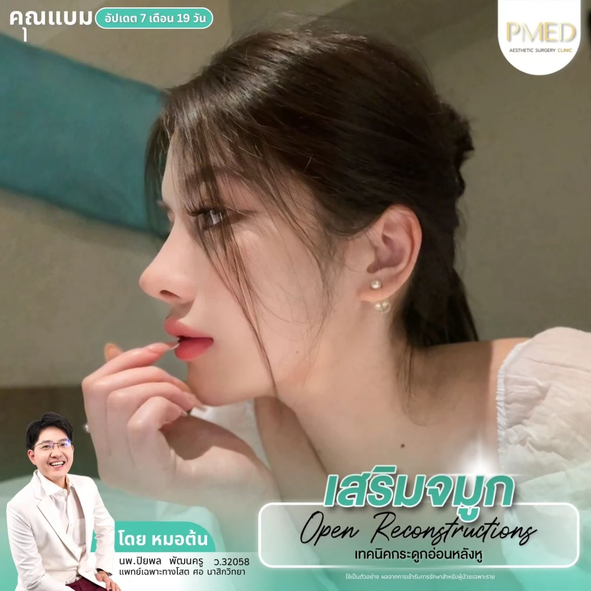 LINE_ALBUM_จมูก 👂🏻 เทคนิคกระดูกอ่อนหลังหู_260715_12