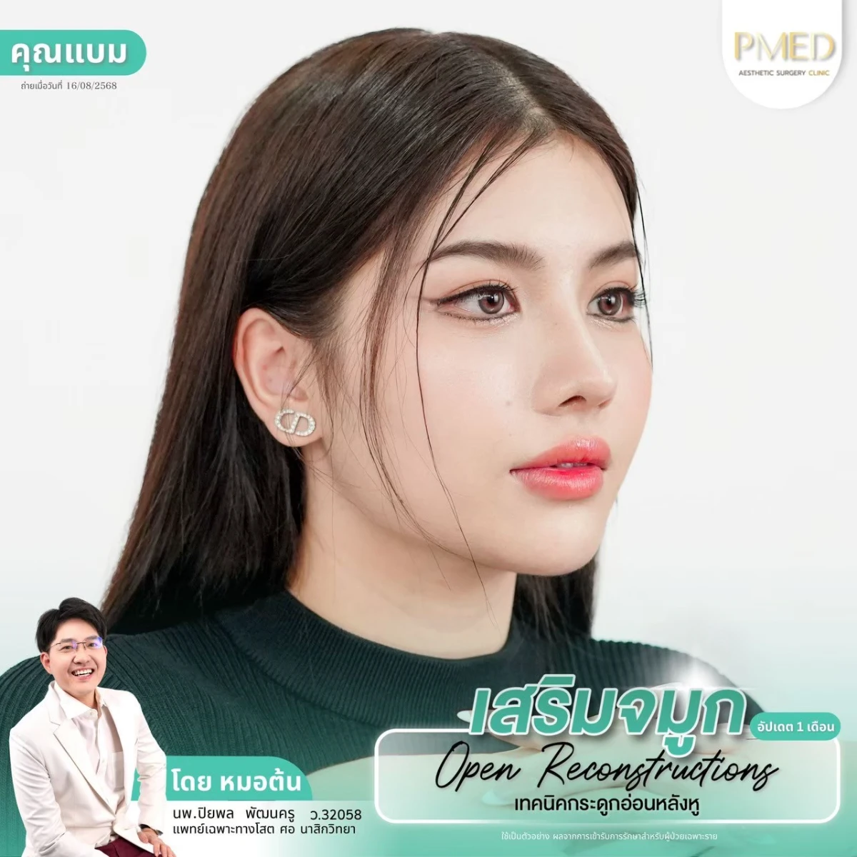 LINE_ALBUM_จมูก 👂🏻 เทคนิคกระดูกอ่อนหลังหู_260715_38