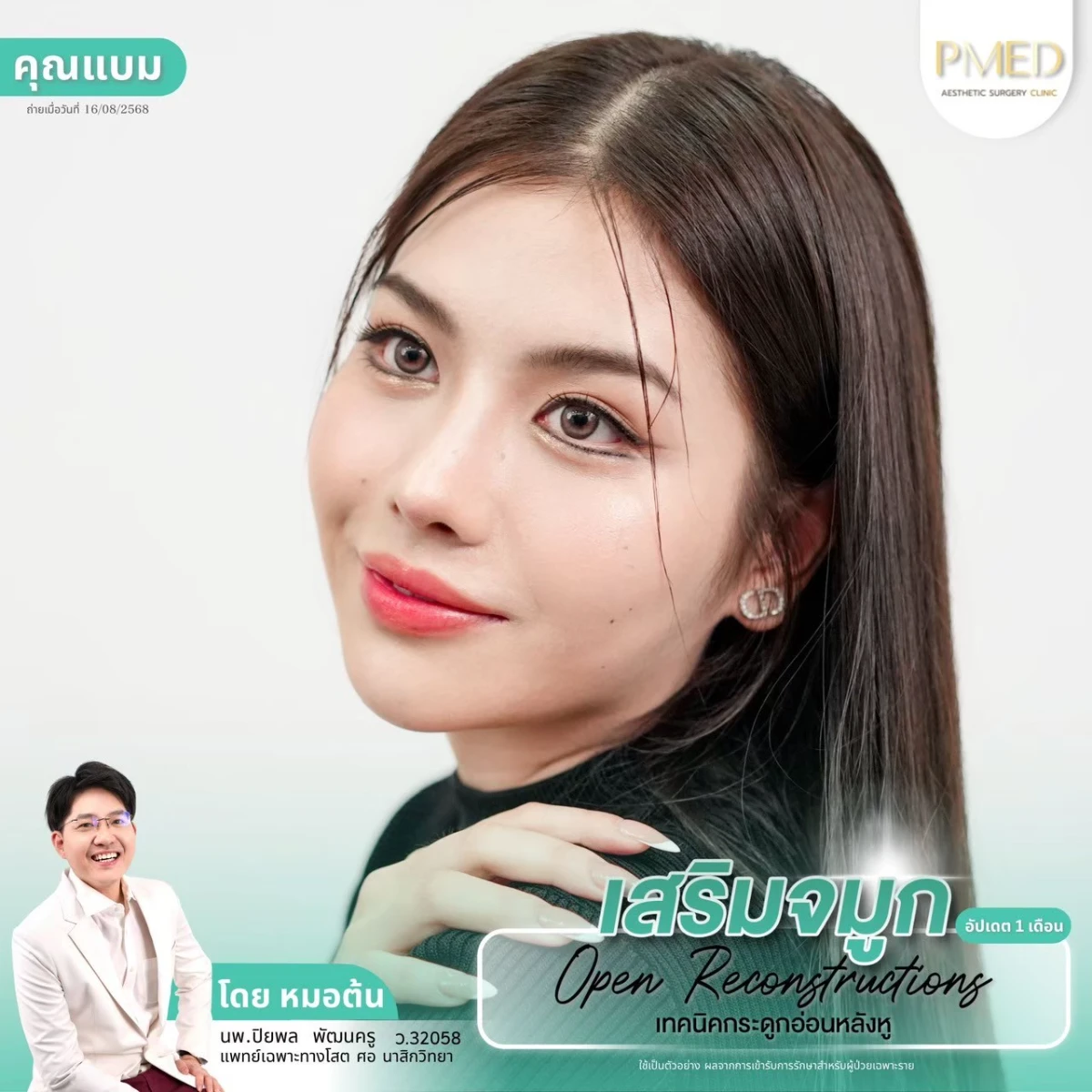 LINE_ALBUM_จมูก 👂🏻 เทคนิคกระดูกอ่อนหลังหู_260715_39