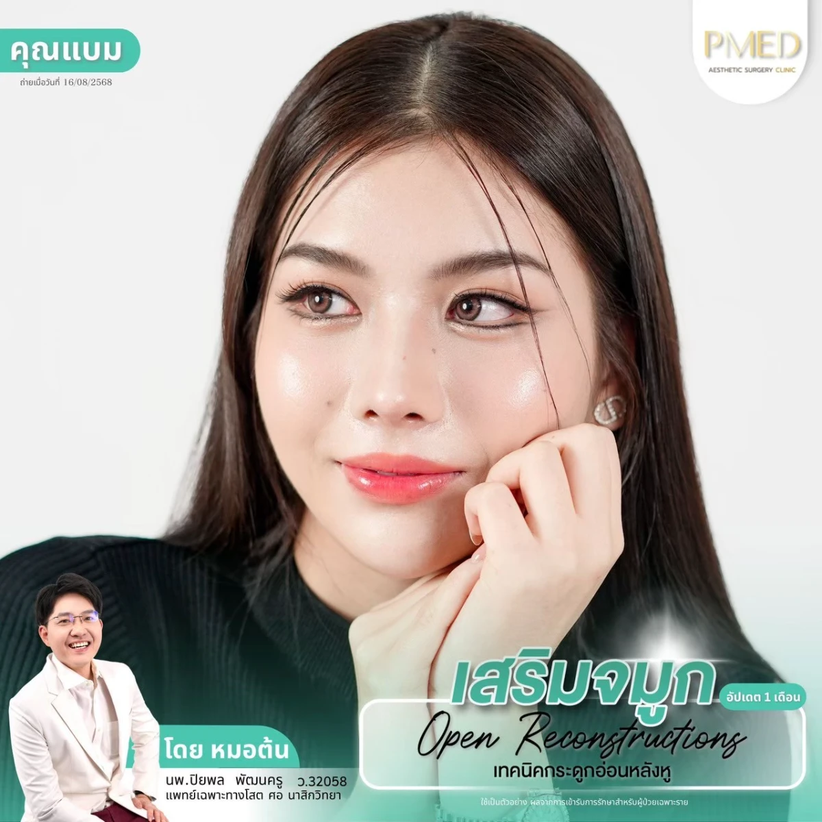 LINE_ALBUM_จมูก 👂🏻 เทคนิคกระดูกอ่อนหลังหู_260715_40